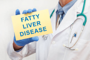 Fatty Liver Disease: Causes, Symptoms, Diagnosis and Treatment
