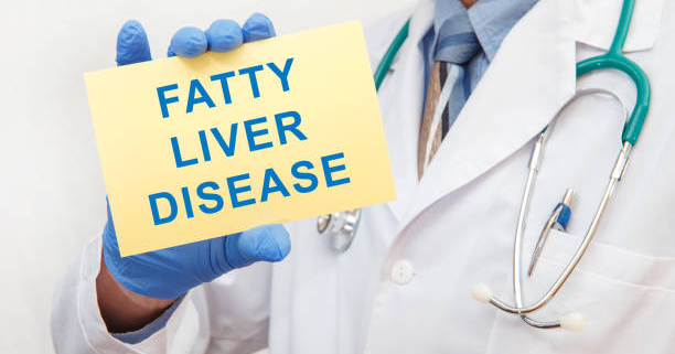 Fatty Liver Disease: Causes, Symptoms, Diagnosis and Treatment
