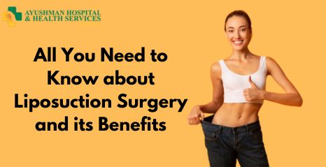 All You Need to Know about Liposuction Surgery and its Benefits