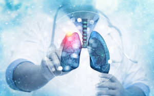 Impact of Acute Respiratory Failure on Lung Health