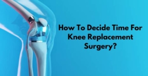 How To Decide Time For Knee Replacement Surgery