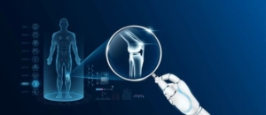 Robotic Knee Replacement