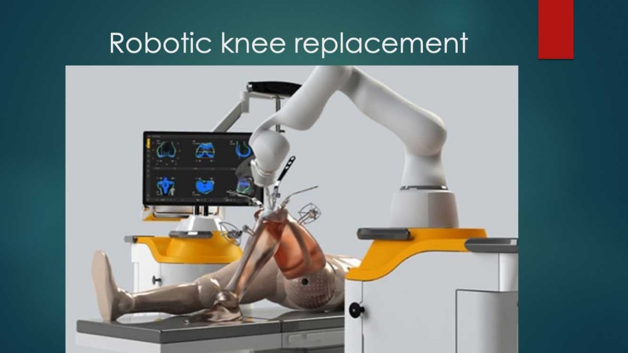 Best Hospital for Robotic Knee Replacement Surgery in Delhi