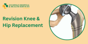 Revision Knee & Hip Replacement