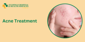 Acne Treatment