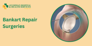 Bankart Repair Surgeries